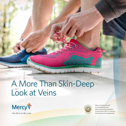 Vein_Treatment_cover